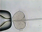 Sperm injection into an egg in IVF