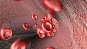 RBC Red Blood Cell variation