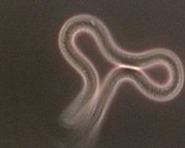 Brugia malayi nematode worm