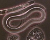 Brugia malayi nematode worm