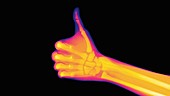 Thumbs up, coloured X-ray