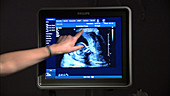 Pregnant woman ultrasound