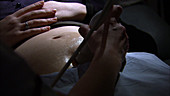 Pregnant woman ultrasound