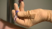 Doctor transferring blood from syringe