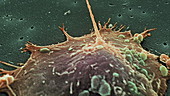 Prostate cancer cell division