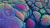 Coloured SEM of cancer cells in the inte