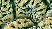 Stomach lining with gastric pits, SEM
