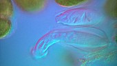 Ciliate protozoa, light micrograph
