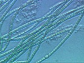 Anabaena algae