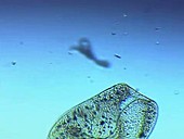 Bursaria truncatella ciliate protozoa