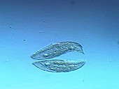 Blepharisma ciliate protozoa