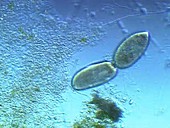 Paramecium fission protozoa