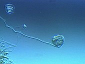 Vorticella ciliate protozoa