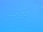 Spiral bacteria