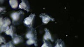 Vorticella protozoa