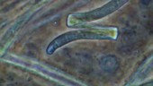 Oscillatoria cyanobacterium trichome