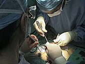 Keyhole mitral valve surgery