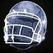 X-Ray of a football helmet