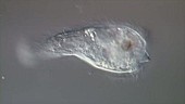 Liver fluke larva