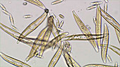 Gyrosigma diatoms