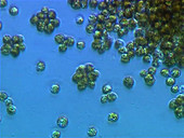 Synura alga cells
