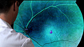 Doctor examining retinal images