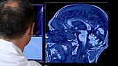 Doctor with brain scans