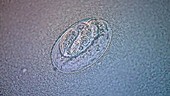 C elegans embryo, light microscopy