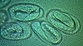 C elegans embryos, light microscopy