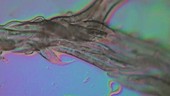 C elegans worms, light microscopy