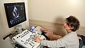 Heart ultrasound procedure