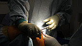 Partial knee replacement surgery