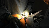 Partial knee replacement surgery