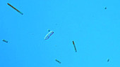 Euglena protozoan