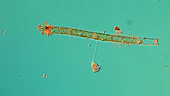 Vorticella protozoan feeding
