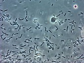 Bacteria from chicken