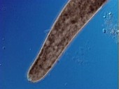 Ciliated protozoa