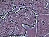 Mitosis in an animal cell