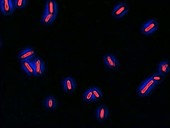 Motility of Pseudomonas aeruginosa