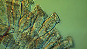 Epistylis ciliate protozoa