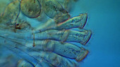 Epistylis ciliate protozoa