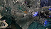 Robotic prostate cancer surgery