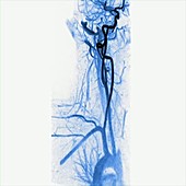 Arteries, MRA scan sequence