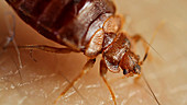 Bedbug feeding on human