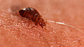 Bedbug feeding on human
