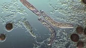 Blepharisma swimming in pond water