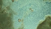 Bacteria shimmering in pond water