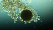 Spirostomum cyst