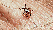 Tick scurrying across skin