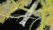 Bdelloid rotifer